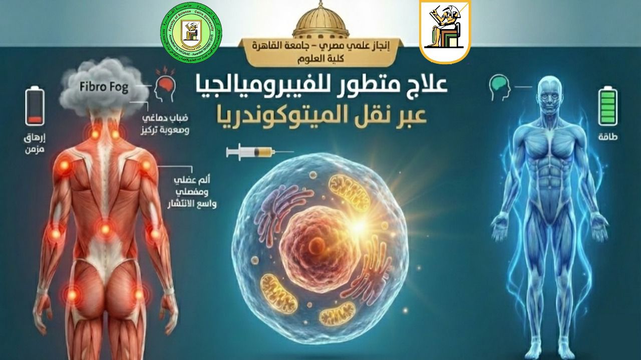 جامعة القاهرة تنجح في علاج أحد الأمراض المستعصية "الفيبروميالجيا"