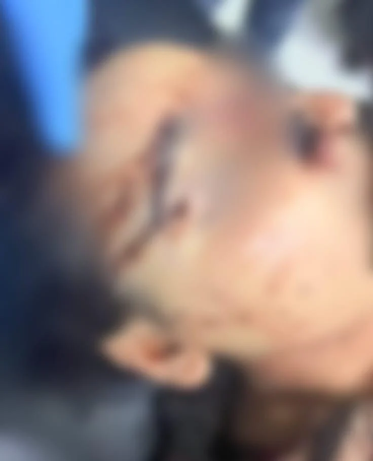 ملابسات فيديو لفتاة مصابة بجروح متفرقة في الشرقية