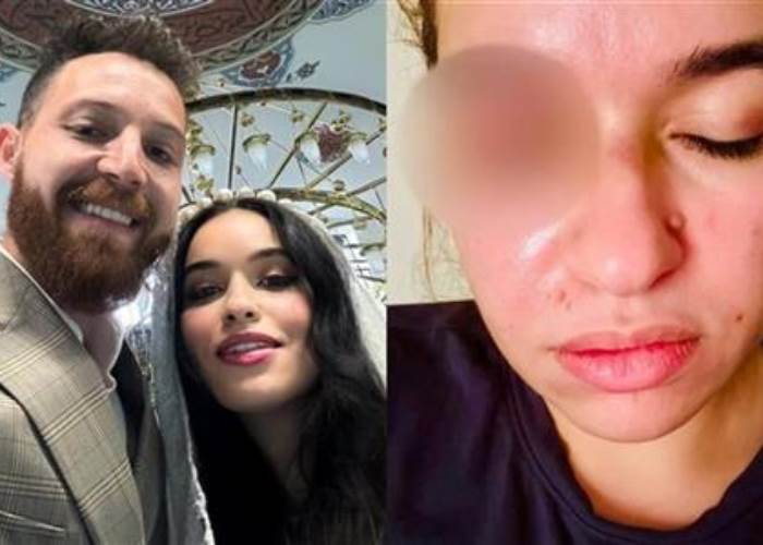 اتعرفوا على تيكتوك.. تطورات جديدة في قضية اتهام الفنان محمود حجازي باغتصاب أجنبية